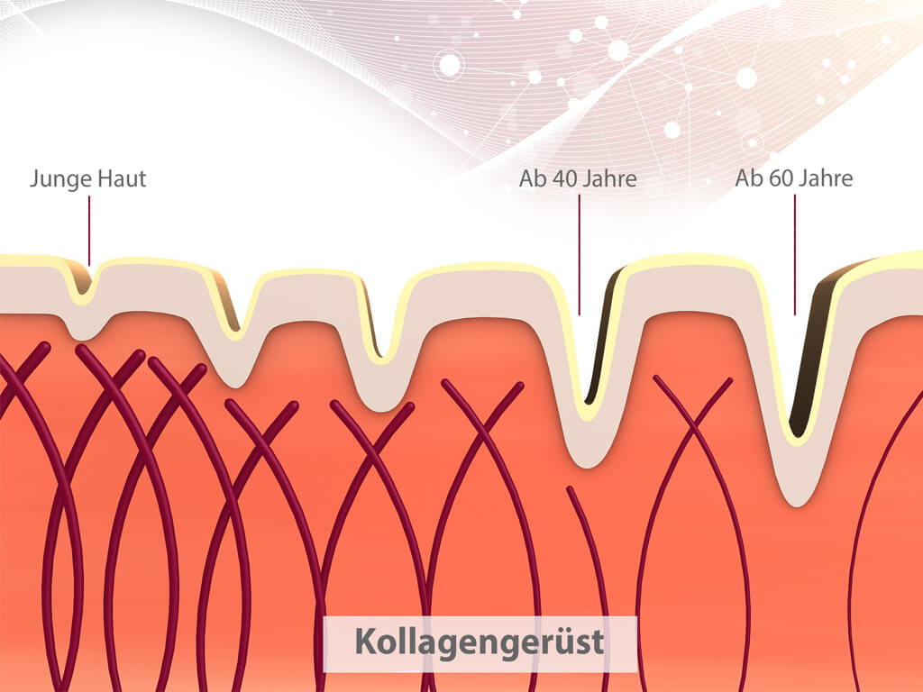 Collagen / Hyaluron